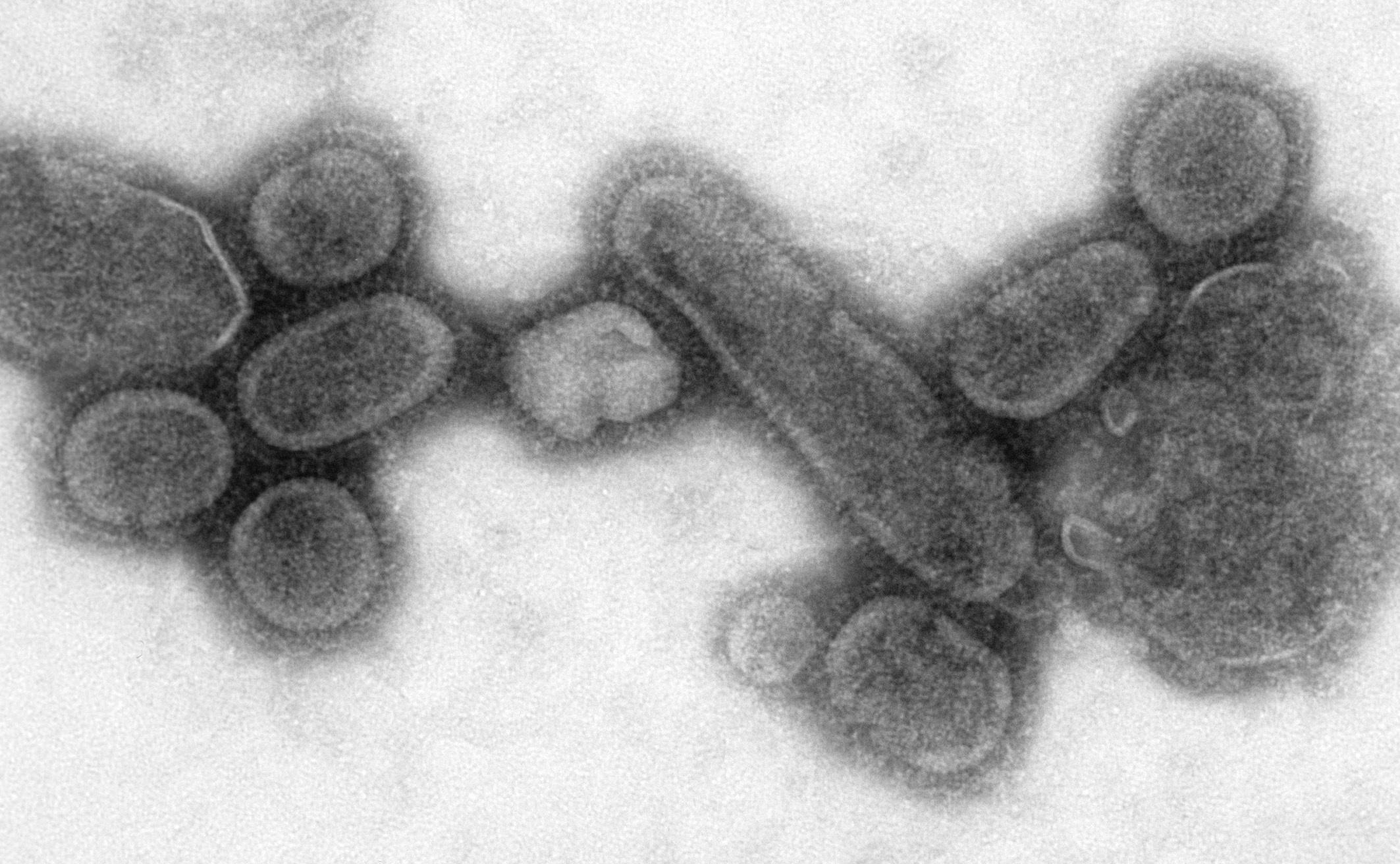 Image result for spanish flu virus