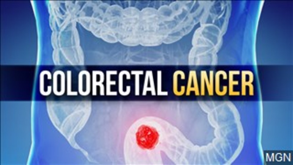 Free Colorectal Cancer Screening Test Kits Available To The Community Free Colorectal Cancer Screening Test Kits Available To The Community